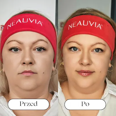 lek. Michał Szostek Medycyna Estetyczna